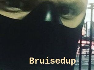 Bruisedup